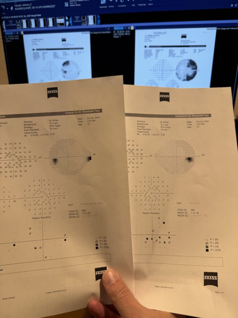 Vision field test